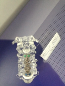 Spinal implants
